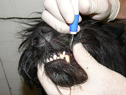 ультразвуковое снятие зубного камня